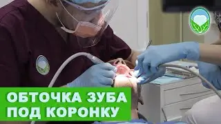 Обточка зуба под коронку | Клиника доктора Осиповой