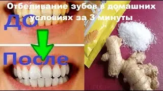 ✔️Как ОТБЕЛИТЬ желтые зубы👍100% результат!!!РЕЦЕПТ ОТБЕЛИВАНИЕ ЗУБОВ в Домашних Условиях за 3 минуты