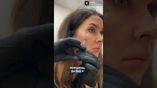 Как колоть ботокс себе- не повторять! #морщины #омоложение #пилинг #уколыкрасоты #косметология #губы