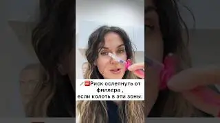 От филлера можно ослепнуть! Это нужно знать #косметология #омоложение #пилинг #губы #морщины #кожа