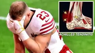 Doctor explains: Christian McCaffrey Achilles Tendinitis in 60 seconds 