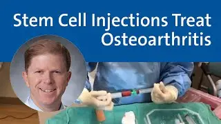 Stem Cell Injections Treat Osteoarthritis | Duke Health