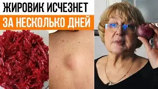 КАК ВЫЛЕЧИТЬ ЖИРОВИК