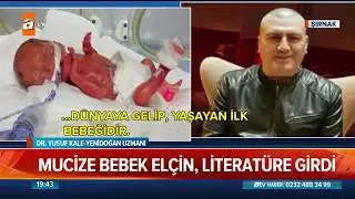 285 gram doğdu şuan 4 kilo! - Atv Haber  29 Kasım 2018