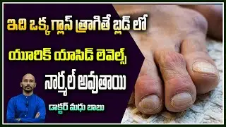 How to reduce Uric acid levels? @Dr.Madhu Babu Health Trends