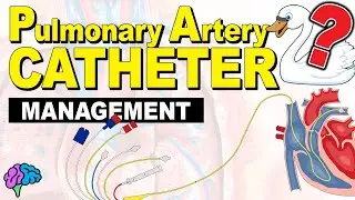 PA Catheter Management