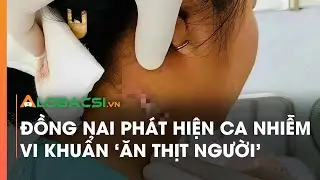 Đồng Nai phát hiện ca nhiễm vi khuẩn 'ăn thịt người’