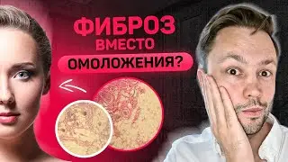 Коллаген от процедур. Омоложение или фиброз?