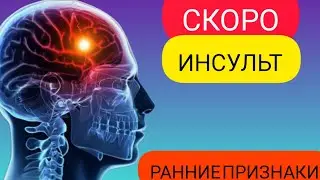 Признаки скорого ИНСУЛЬТА! Тело предупреждает за Час.НЕ пропусти   спасешь БЛИЗКОГО