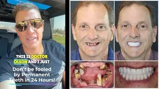 Don’t be fooled by PERMANENT TEETH IN 24 HOURS with All-On-4 Dental Implants!