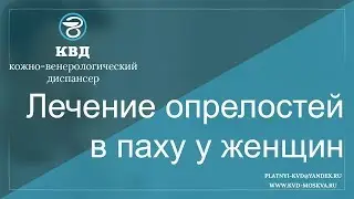 521  Лечение опрелостей в паху у женщин