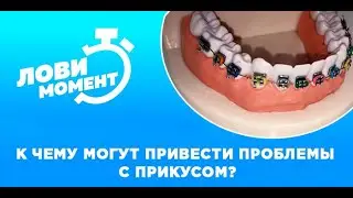 Лови момент: как получить красивую улыбку