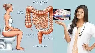 Managing Constipation While on Ozempic: Tips & Cautions : laxative shartage