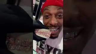 😂 THE DRIPGOD MILLION DOLLAR SMILE NEVER BEEN DONE 3CT-1CT 28 TEETH ALL GIA CERTIFIED DO THE MATH🤯