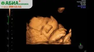 3D УЗИ, 30 недель беременности. Клиника 