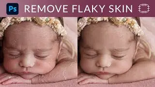 Remove Flaky Skin From Face In Photoshop