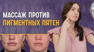 Пигментные пятна на лице | Как избавиться?