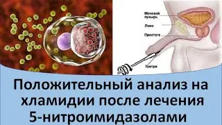 Положительный анализ на хламидии после лечения 5 нитроимидазолами