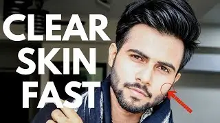 How To Get Clear Glowing Skin Naturally For Men | Skin Care Tips