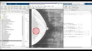 Deep learning in Breast Cancer mammography images segmentation & classification | Improve Detection