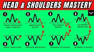 ULTIMATE Head And Shoulders Pattern Trading Course (PRICE ACTION MASTERY)