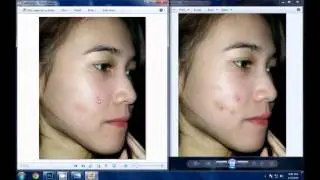 How to remove pimples from face in Photoshop cs6