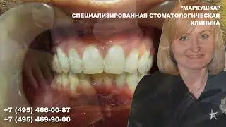 Детская стоматология. ПОЧЕМУ РОДИТЕЛИ ВЫБИРАЮТ НАШУ КЛИНИКУ