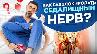 Как разблокировать седалищный нерв без боли! Ишиаса как не бывало