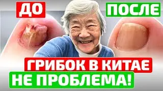 Вот как за 20 мин в китайской народной медицине избавляются от грибка ногтей
