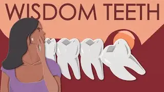 Why are wisdom teeth so annoying?