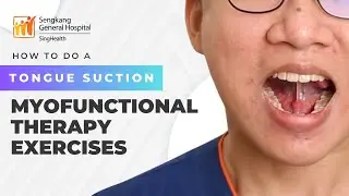 Do this to STOP SNORING and prevent SLEEP APNEA! Tongue Suction - Myofunctional Therapy | 3 of 5