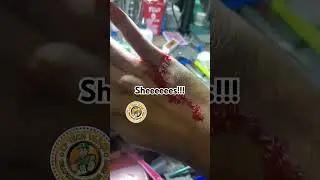 accident slice my skin