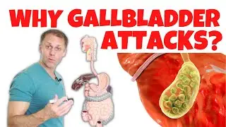 Understanding Gallbladder Attacks