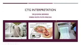 CTG Interpretation