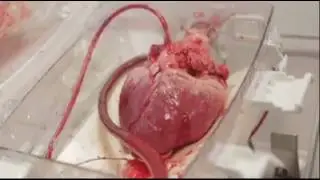 Human Heartbeat Sound