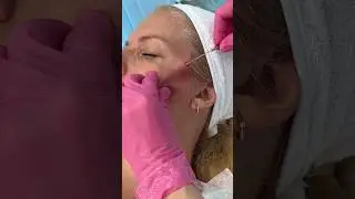 Авторская техника комплексного безоперационного омоложения FULLFACE🔥Остановите процессы старения❗️
