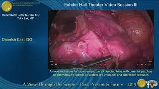 A novel technique for laparoscopic gastric feeding tube with...