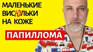 Вирус папилломы человека (ВПЧ) | Доктор Елизаров: Первая помощь и   Здоровье кожи