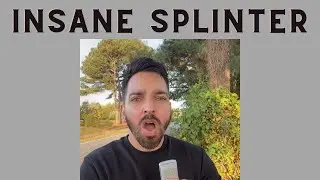 Doctor Reacts to INSANE Splinter | 