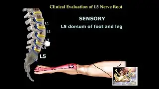 Neurological Evaluation Of The Lumbar Nerve Roots - Everything You Need To Know - Dr. Nabil Ebraheim