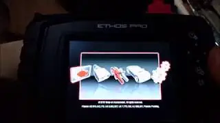 How a scan tool can help you diagnose an electrical circuit