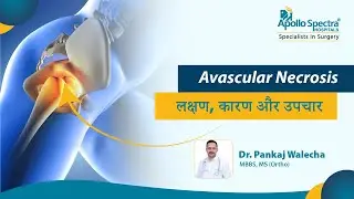 Avascular Necrosis - लक्षण, शीघ्र निदान, कारण और उपचार। (In Hindi)