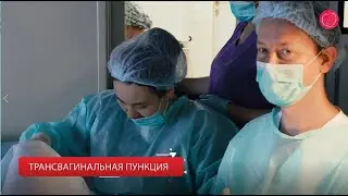 Пункция фолликулов. Оплодотворение и перенос эмбриона в полость матки