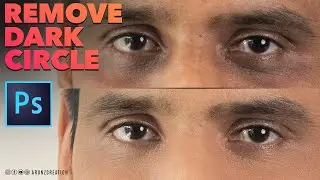 Removing Dark Circles In Photoshop CC Tutorial