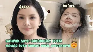 Banyak Hate Comments?! CUEK! Mawar Suka Banget Hasil Operasinya!🤩😱