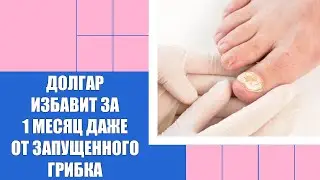 Какую мазь от грибка лучше отзывы