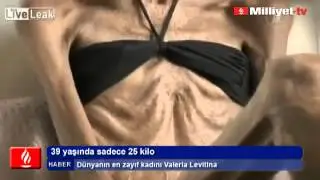 39 yaşında sadece 25 kilo