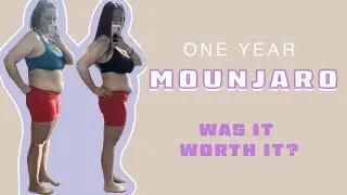 Before and After: One Year Mounjaro Results!