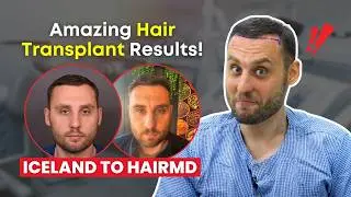 You Won’t Believe This Patient’s Results! | Iceland Patient’s Hair Transplant Journey at HairMD