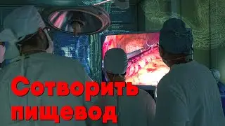 Сотворить пищевод (18+) | Оперативное вмешательство